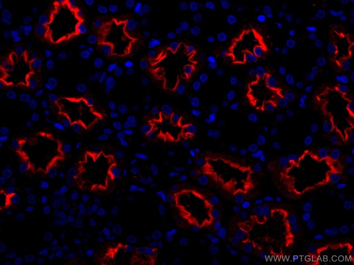 [CL594-66699-100UL] CoraLite®594-conjugated ACE2 Monoclonal antibody