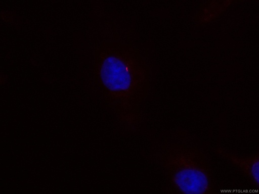 [CL594-66739-100UL] CoraLite®594-conjugated ARL13B Monoclonal antibody