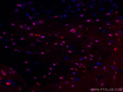 [CL594-66786-100UL] CoraLite®594-conjugated SOX10 Monoclonal antibody