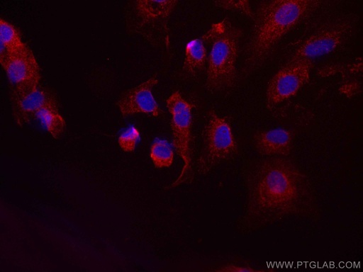 [CL594-66798-100UL] CoraLite®594-conjugated HPGD Monoclonal antibody
