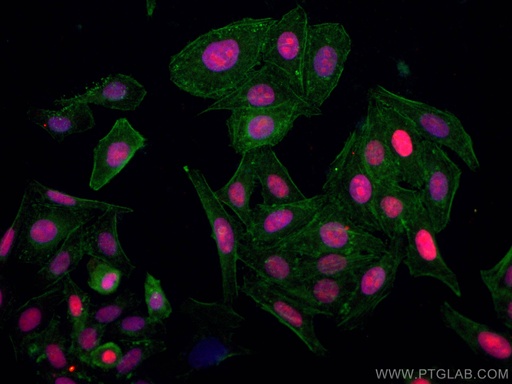 [CL594-66884-100UL] CoraLite®594-conjugated ASF1A Monoclonal antibody
