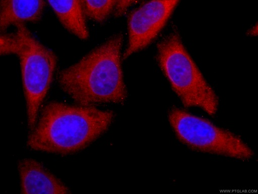 [CL594-66900-100UL] CoraLite®594-conjugated YAP1 Monoclonal antibody