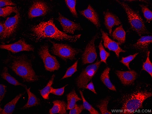 [CL594-66926-100UL] CoraLite®594-conjugated GPNMB Monoclonal antibody