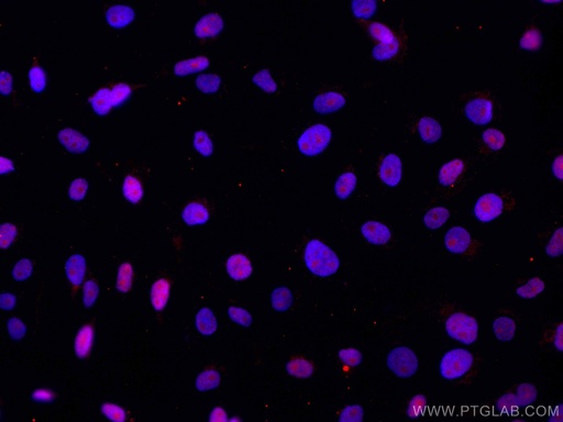 [CL594-66951-100UL] CoraLite®594-conjugated DBR1 Monoclonal antibody
