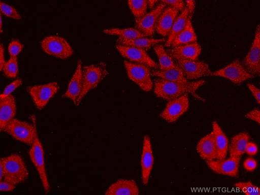 [CL594-66954-100UL] CoraLite®594-conjugated FGFR3 Monoclonal antibody