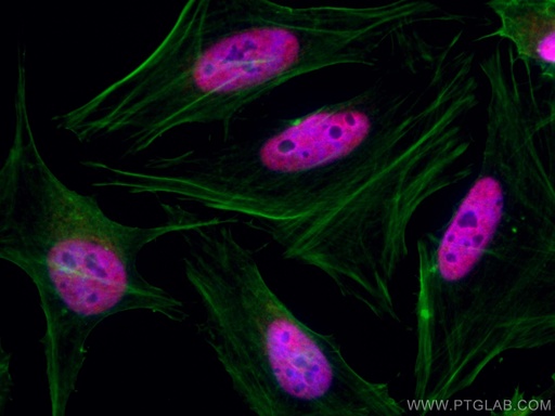 [CL594-66955-100UL] CoraLite®594-conjugated TBL1X Monoclonal antibody