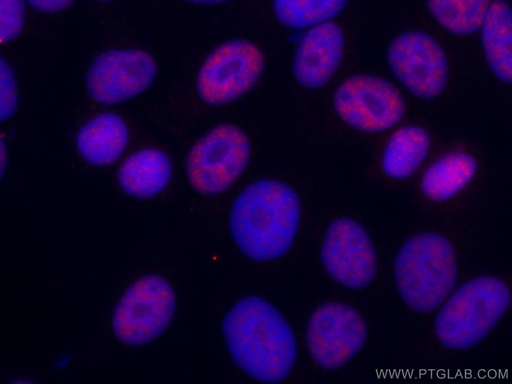 [CL594-67025-100UL] CoraLite®594-conjugated DDX5 Monoclonal antibody