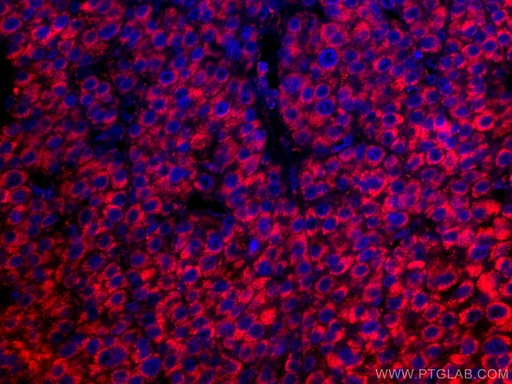 [CL594-67026-100UL] CoraLite®594-conjugated GLUD1 Monoclonal antibody