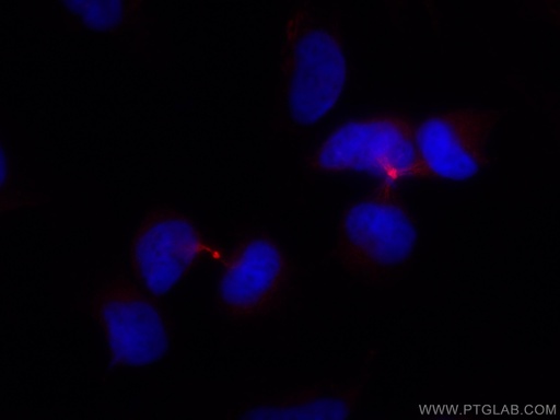 [CL594-67027-100UL] CoraLite®594-conjugated PRC1 Monoclonal antibody