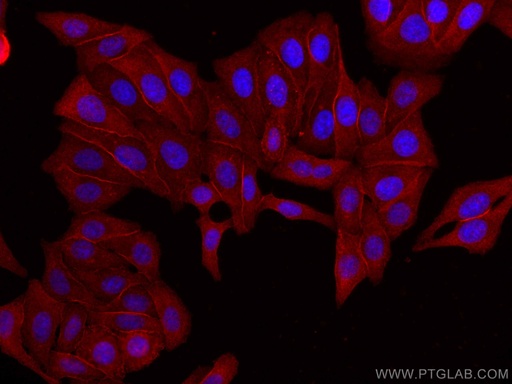 [CL594-67063-100UL] CoraLite®594-conjugated C1QA Monoclonal antibody