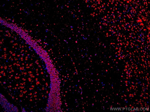 [CL594-67077-100UL] CoraLite®594-conjugated APBB1 Monoclonal antibody