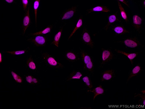 [CL594-67121-100UL] CoraLite®594-conjugated PI3 Kinase p110 Beta Monoclonal antibody