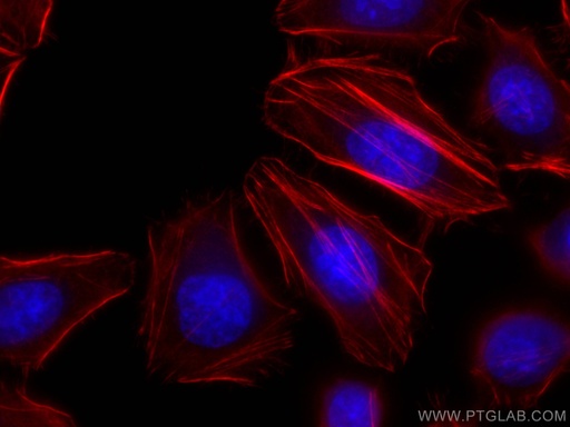 [CL594-67133-100UL] CoraLite®594-conjugated FLNA Monoclonal antibody