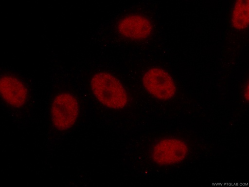 [CL594-67140-100UL] CoraLite®594-conjugated TCF3 Monoclonal antibody