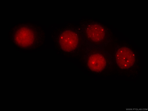 [CL594-67154-100UL] CoraLite®594-conjugated SUMO2/3 Monoclonal antibody