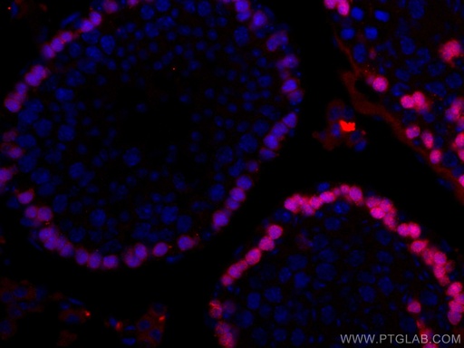 [CL594-67176-100UL] CoraLite®594-conjugated DMC1 Monoclonal antibody