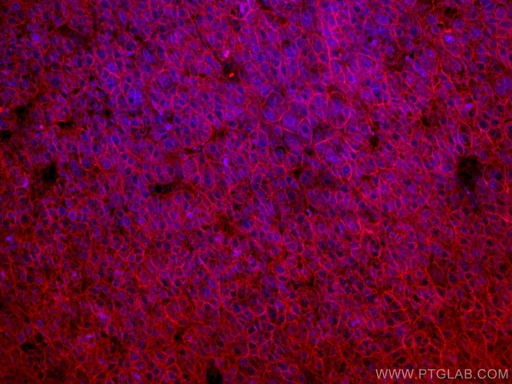 [CL594-67221-100UL] CoraLite®594-conjugated SLC31A1 Monoclonal antibody