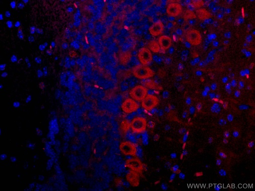 [CL594-67243-100UL] CoraLite®594-conjugated MYH10 Monoclonal antibody
