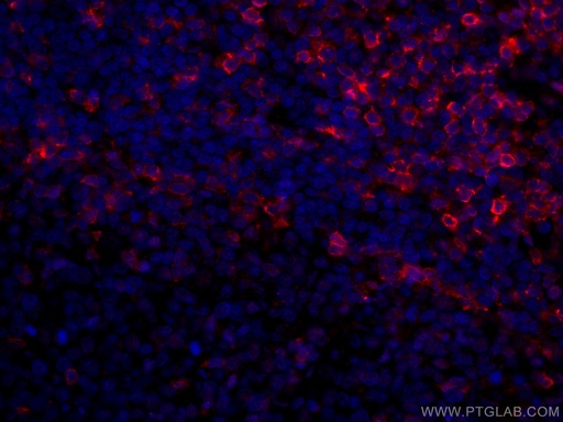 [CL594-67278-100UL] CoraLite®594-conjugated CD5 Monoclonal antibody