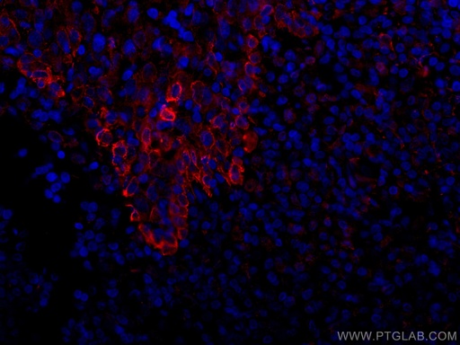 [CL594-67317-100UL] CoraLite®594-conjugated TLR8 Monoclonal antibody