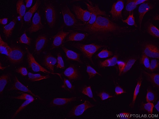 [CL594-67329-100UL] CoraLite®594-conjugated GSK3B Monoclonal antibody