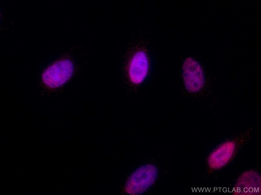 [CL594-67335-100UL] CoraLite®594-conjugated RCC1 Monoclonal antibody