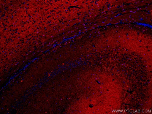 [CL594-67339-100UL] CoraLite®594-conjugated SYNPO Monoclonal antibody