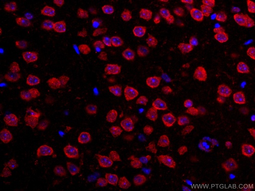 [CL594-67342-100UL] CoraLite®594-conjugated TRIM2 Monoclonal antibody