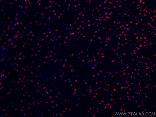 [CL594-67345-100UL] CoraLite®594-conjugated TDP-43 (C-terminal) Monoclonal antibody