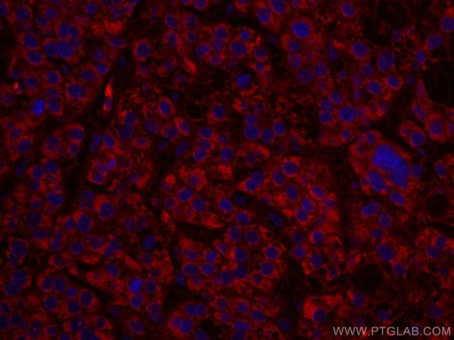 [CL594-67347-100UL] CoraLite®594-conjugated ALDH5A1 Monoclonal antibody