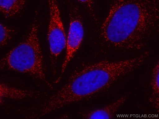 [CL594-67369-100UL] CoraLite®594-conjugated PNPLA3 Monoclonal antibody