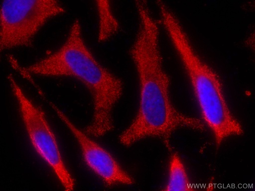 [CL594-67372-100UL] CoraLite®594-conjugated ALDH9A1 Monoclonal antibody