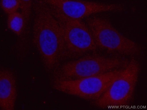 [CL594-67373-100UL] CoraLite®594-conjugated ACC Monoclonal antibody