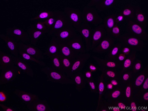 [CL594-67375-100UL] CoraLite®594-conjugated HNRNPH1 Monoclonal antibody