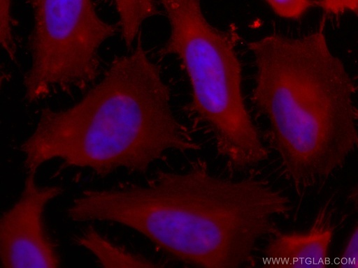 [CL594-67390-100UL] CoraLite®594-conjugated PFN1 Monoclonal antibody