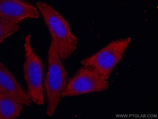 [CL594-67409-100UL] CoraLite®594-conjugated SEC24D Monoclonal antibody