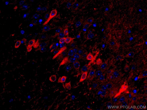 [CL594-67417-100UL] CoraLite®594-conjugated ACVR1 Monoclonal antibody