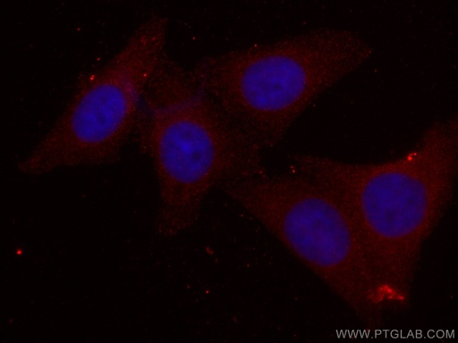 [CL594-67440-100UL] CoraLite®594-conjugated PPM1D Monoclonal antibody