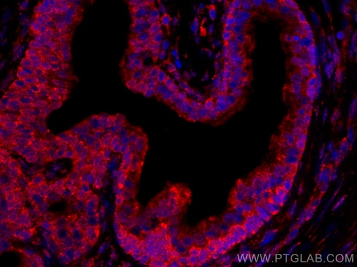 [CL594-67451-100UL] CoraLite®594-conjugated TAOK3 Monoclonal antibody