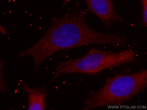 [CL594-67519-100UL] CoraLite®594-conjugated CMPK1 Monoclonal antibody