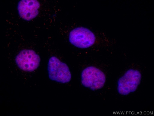 [CL594-67520-100UL] CoraLite®594-conjugated PDS5A Monoclonal antibody