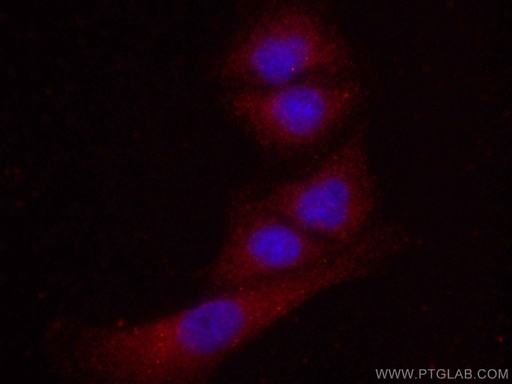 [CL594-67524-100UL] CoraLite®594-conjugated FES Monoclonal antibody