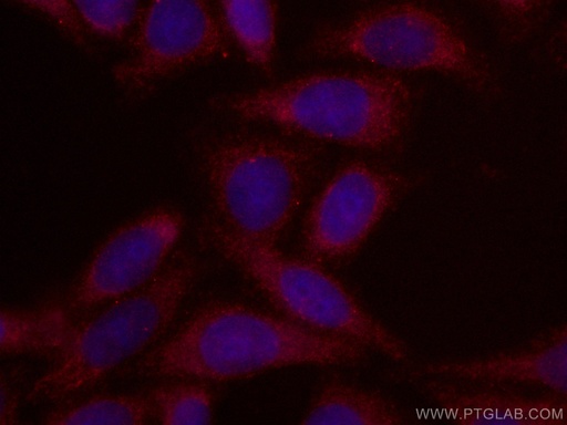 [CL594-67563-100UL] CoraLite®594-conjugated GRP75 Monoclonal antibody