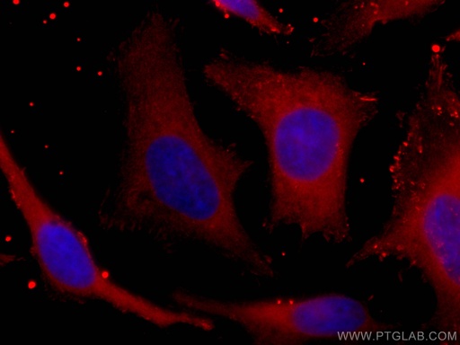 [CL594-67591-100UL] CoraLite®594-conjugated PHGDH Monoclonal antibody