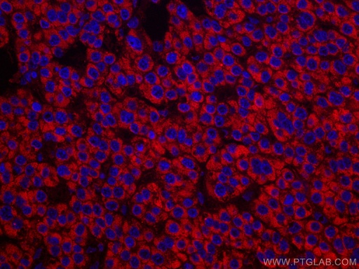 [CL594-67600-100UL] CoraLite®594-conjugated SDHB Monoclonal antibody