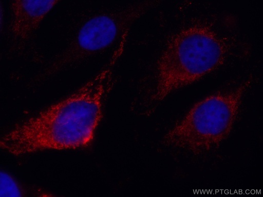 [CL594-67665-100UL] CoraLite®594-conjugated SNX5 Monoclonal antibody