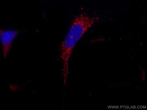[CL594-67696-100UL] CoraLite®594-conjugated SNF8 Monoclonal antibody