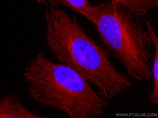 [CL594-67727-100UL] CoraLite®594-conjugated ATG4B Monoclonal antibody