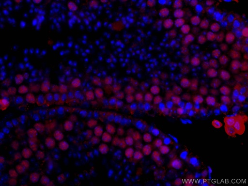 [CL594-67733-100UL] CoraLite®594-conjugated METTL3 Monoclonal antibody
