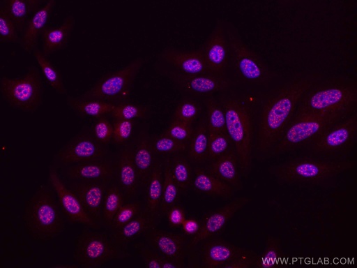 [CL594-67778-100UL] CoraLite®594-conjugated Phospho-mTOR (Ser2448) Monoclonal antibody